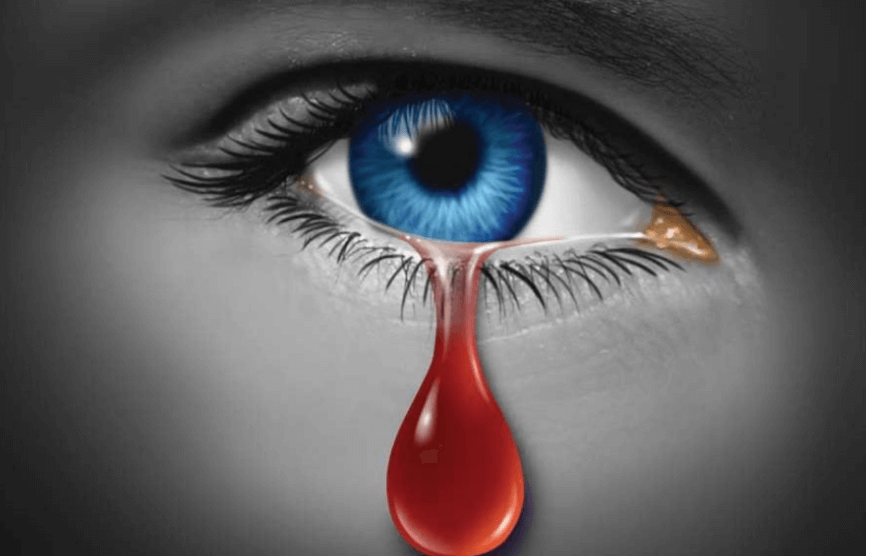 Eye Trauma